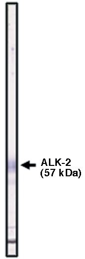 "
Western blot using ALK-2 antibody (cat. no. X1482P) on ALK-2 fusion protein."